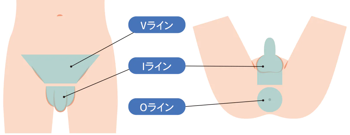 VIOの各部位